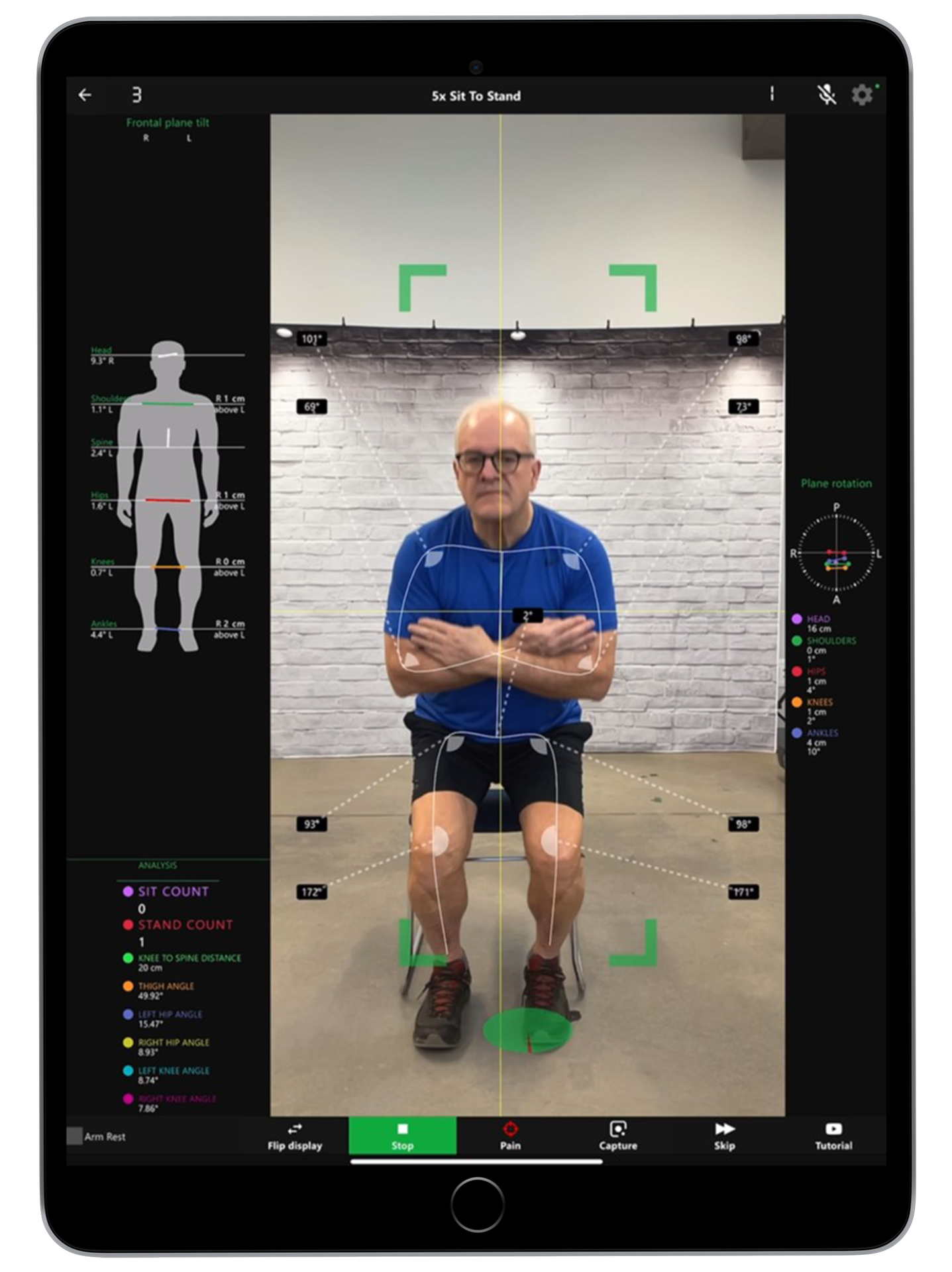 Real clinical photo — Dr. Bekkum performing the 5x Sit-to-Stand Kinetisense assessment on an iPad with a patient